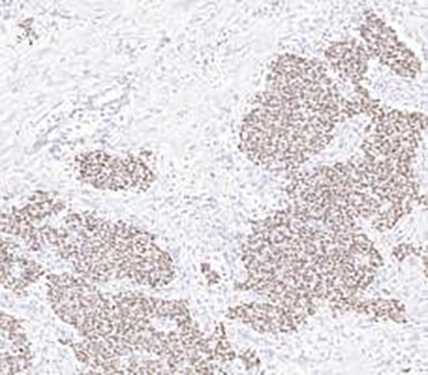 NKX2.2 Recombinant Rabbit Monoclonal Antibody (clone BP6292)