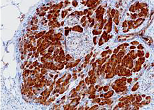 CLPS Recombinant Rabbit Monoclonal Antibody (clone BP6281)