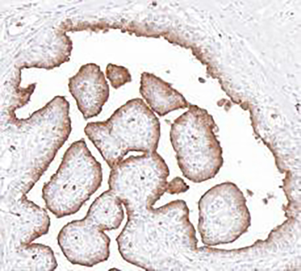 CD63 Recombinant Rabbit Monoclonal Antibody (clone BP6271)