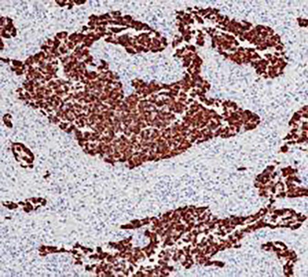 CK5&6 Recombinant Rabbit Monoclonal Antibody (clone BP6252)
