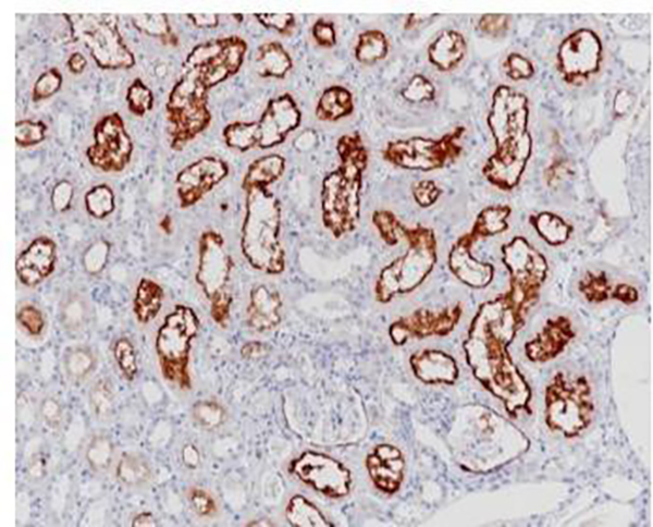 MDR-1 Recombinant Rabbit Monoclonal Antibody (clone BP6260)