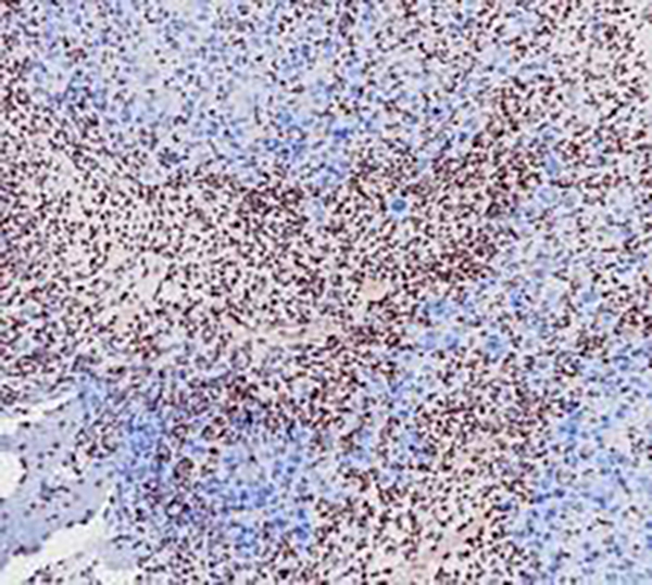 SNF5 Recombinant Rabbit Monoclonal Antibody (clone BP6263)