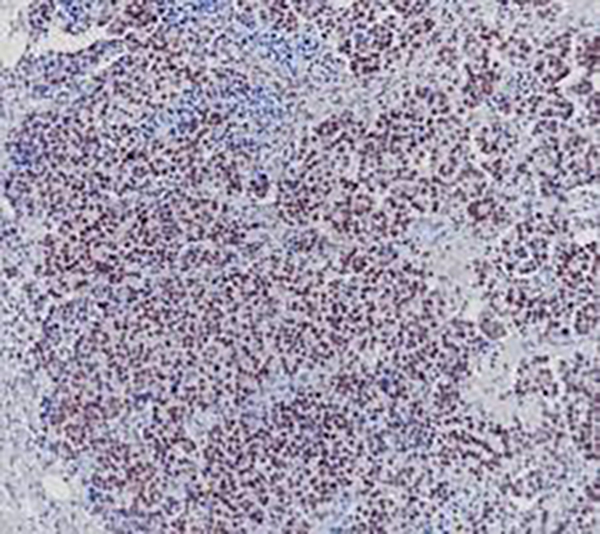Glucagon Recombinant Rabbit Monoclonal Antibody (clone BP6265)
