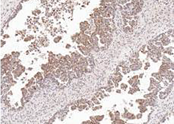 HE4 Recombinant Rabbit Monoclonal Antibody (clone BP6287)