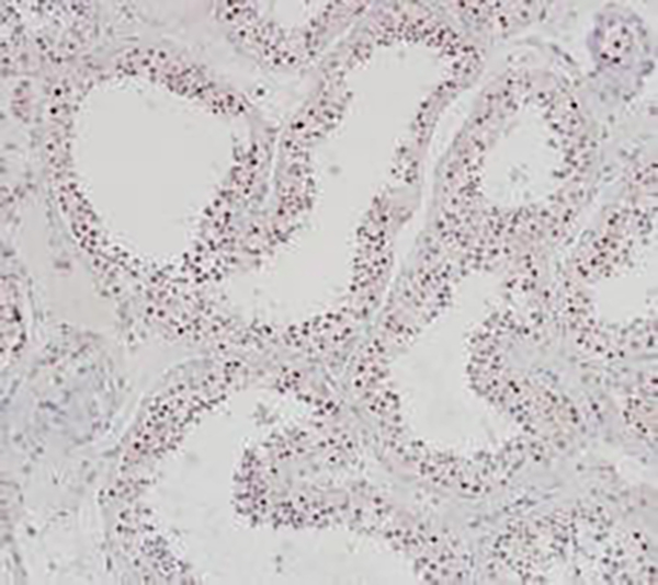 EZHIP Recombinant Rabbit Monoclonal Antibody (clone BP6273)