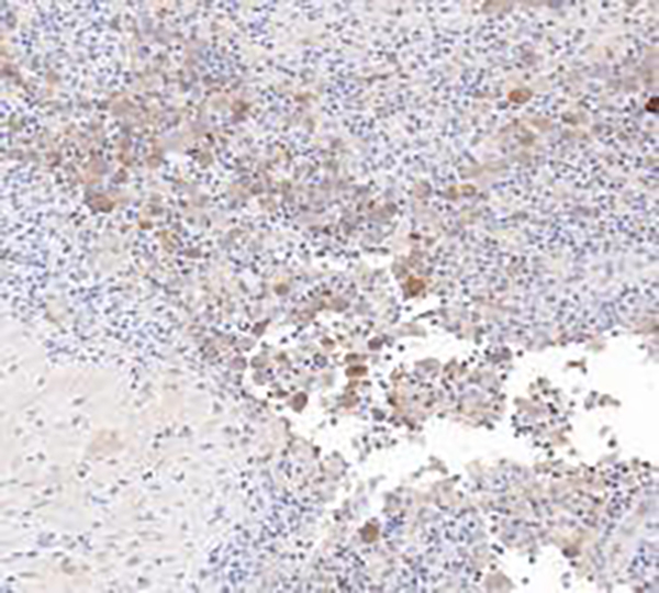 Clusterin Recombinant Rabbit Monoclonal Antibody (clone BP6268)