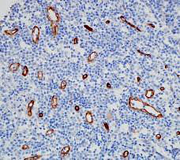 OVOL2 Recombinant Rabbit Monoclonal Antibody (clone BP6285)
