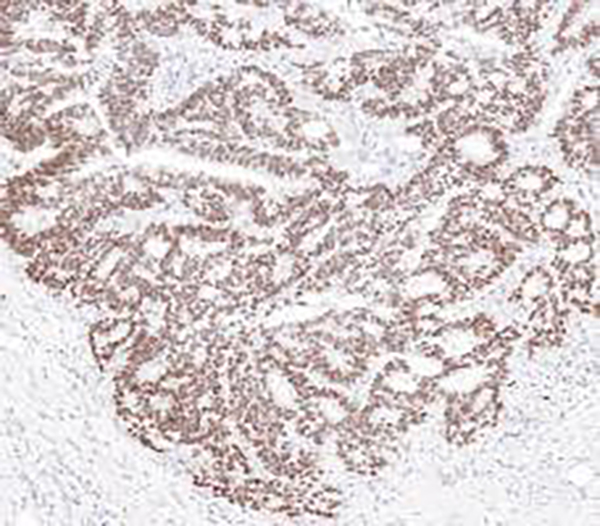 Nkx3.1 Recombinant Rabbit Monoclonal Antibody (clone BP6299)