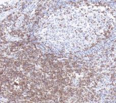 CD3D Recombinant Rabbit Monoclonal Antibody (clone BP6277)