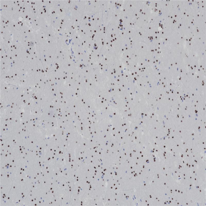 Olig2 Recombinant Rabbit Monoclonal Antibody (clone BP6167)