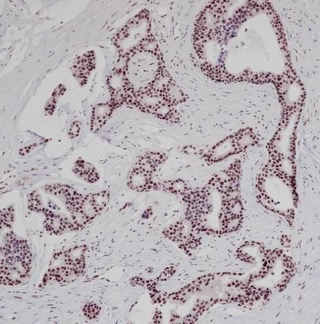 ATRX Recombinant Rabbit Monoclonal Antibody (clone BP6202)
