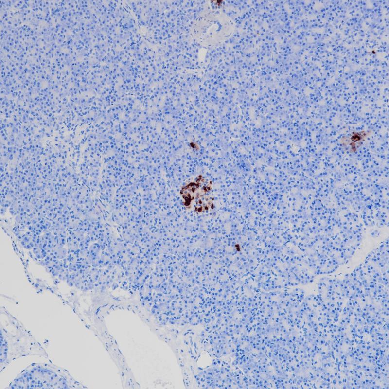 Somatostatin Recombinant Rabbit Monoclonal Antibody (clone BP6200)