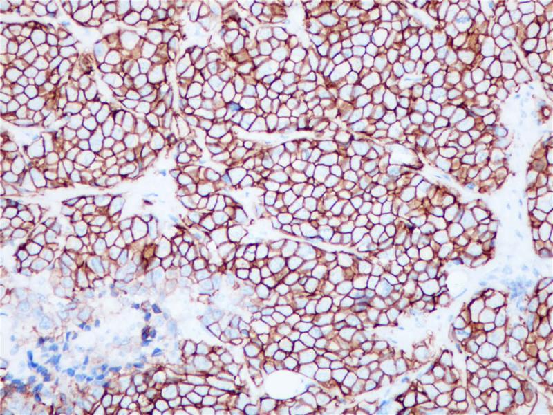 HER2 Rabbit Monoclonal Antibody(ARB820)