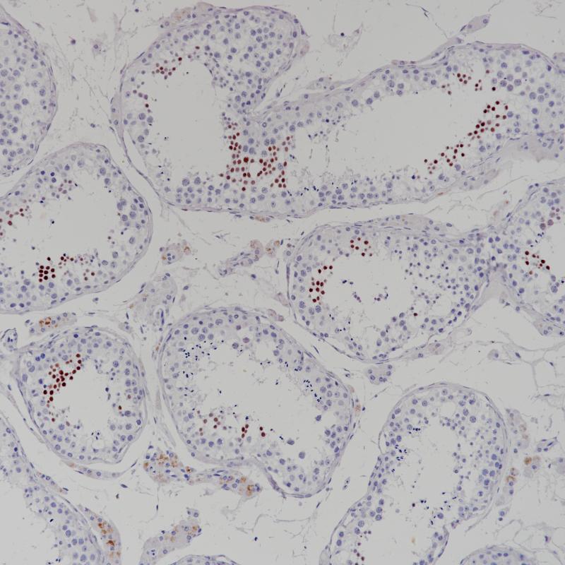 NUT1 Rabbit Monoclonal Antibody(ARB864)