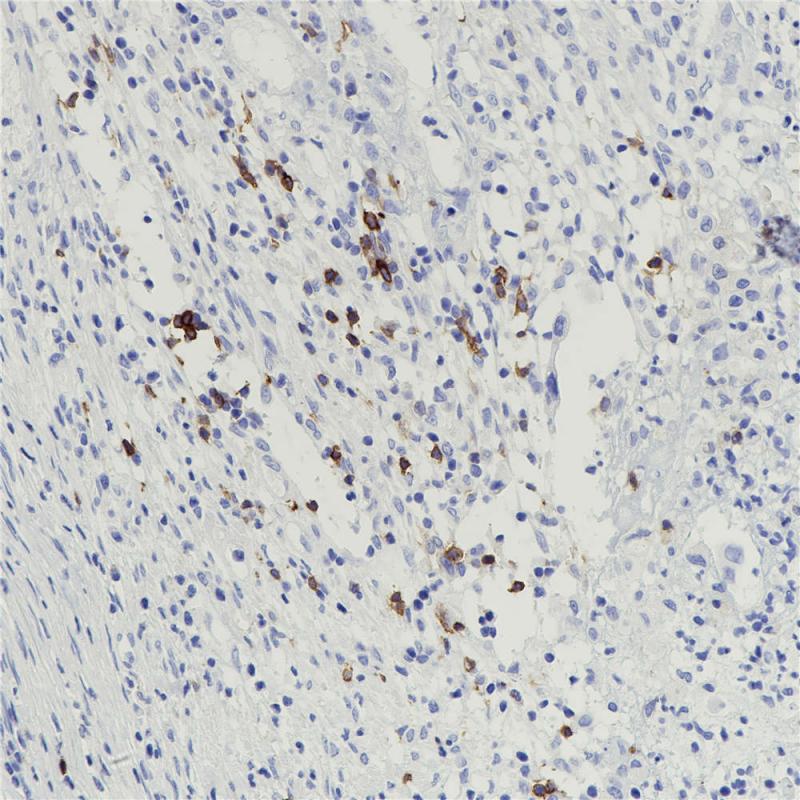 CD25 Rabbit Monoclonal Antibody(ARB900)