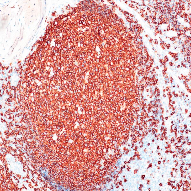 CD20 Rabbit Monoclonal Antibody(ARB896)