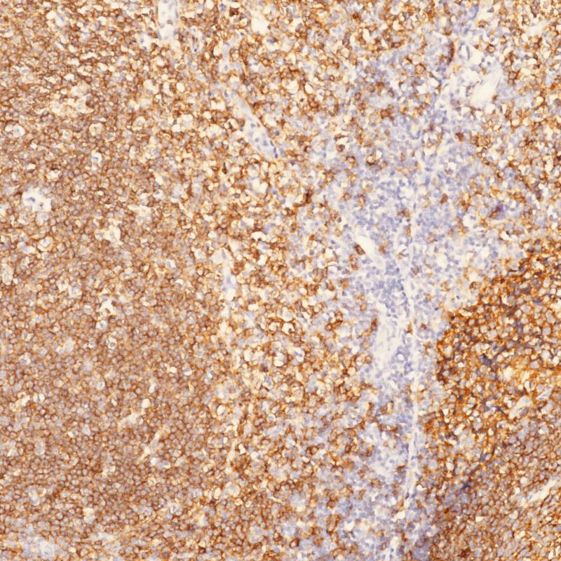 CD19 Rabbit Monoclonal Antibody(ARB893)
