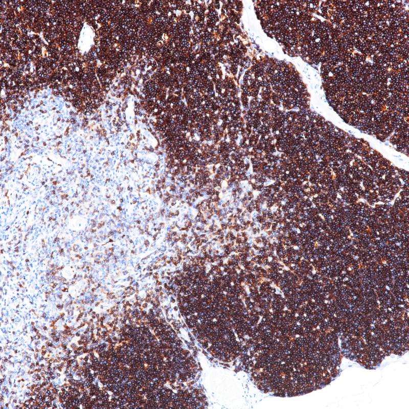 CD1a Rabbit Monoclonal Antibody(ARB894)