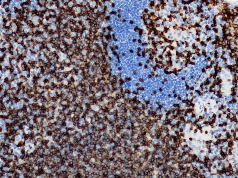 CD3 Rabbit Monoclonal Antibody(ARB901)