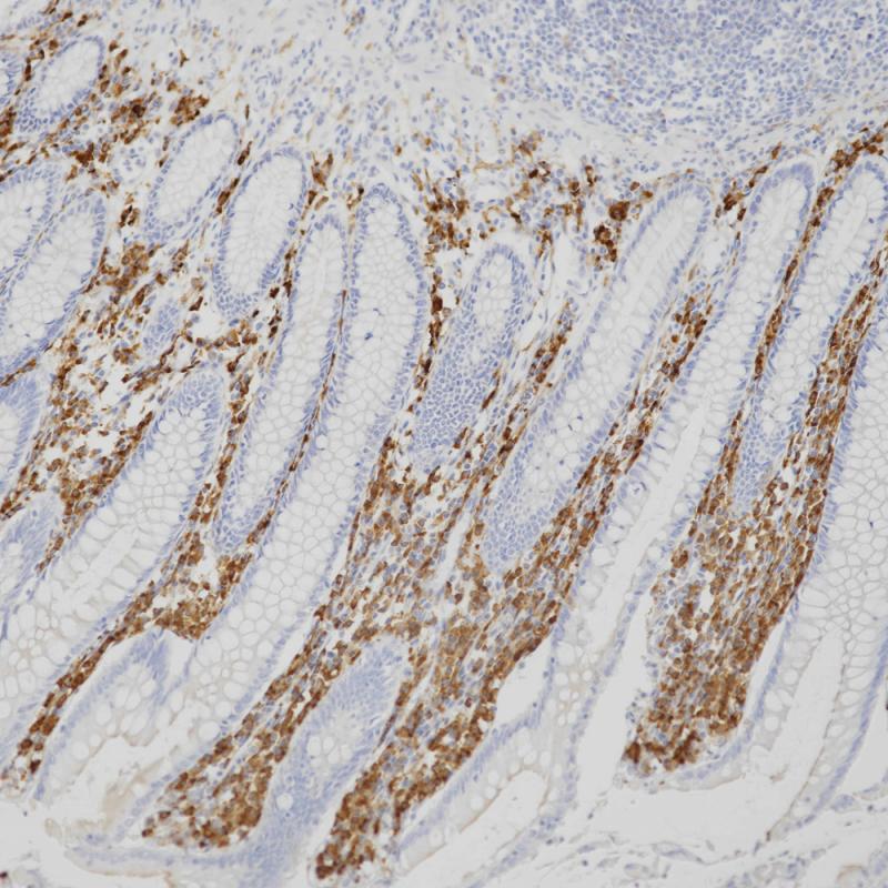 CD14 Rabbit Monoclonal Antibody(ARB890)