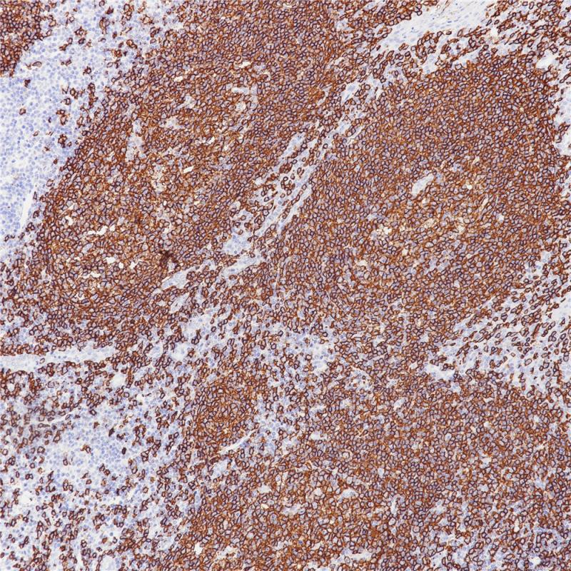 CD20 Rabbit Monoclonal Antibody(ARB897)