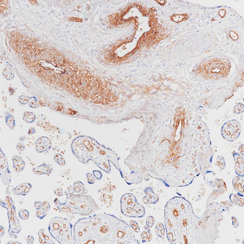 CD146 Rabbit Monoclonal Antibody(ARB891)