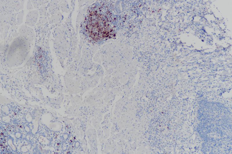 CD23 Rabbit Monoclonal Antibody(ARB899)