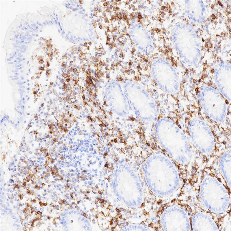 CD38 Rabbit Monoclonal Antibody(ARB906)