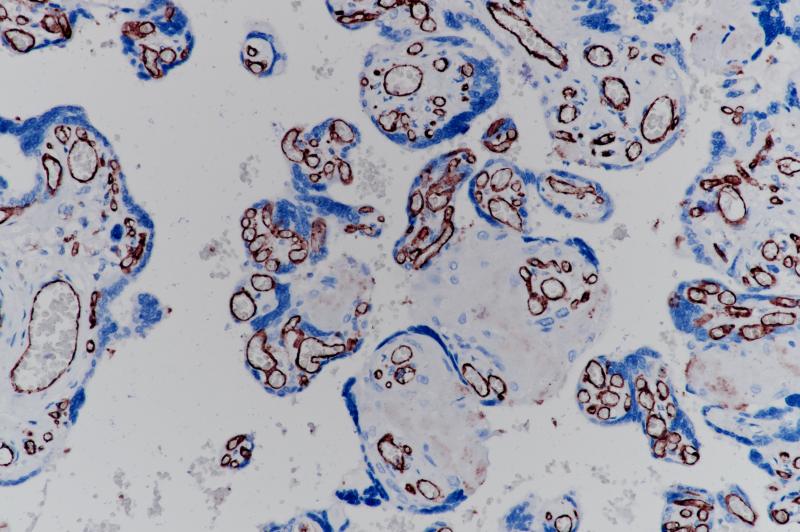 CD31 Rabbit Monoclonal Antibody(ARB903)