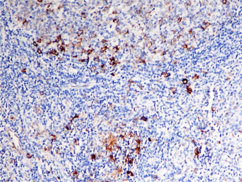 CD30 Rabbit Monoclonal Antibody(ARB902)