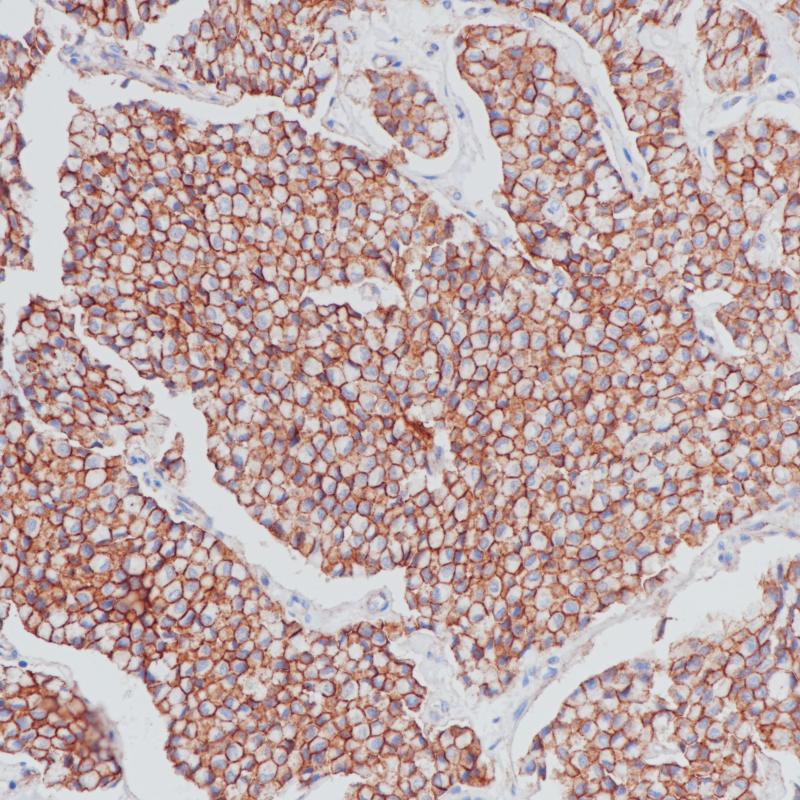 Beta-Catenin Rabbit Monoclonal Antibody(ARB882)
