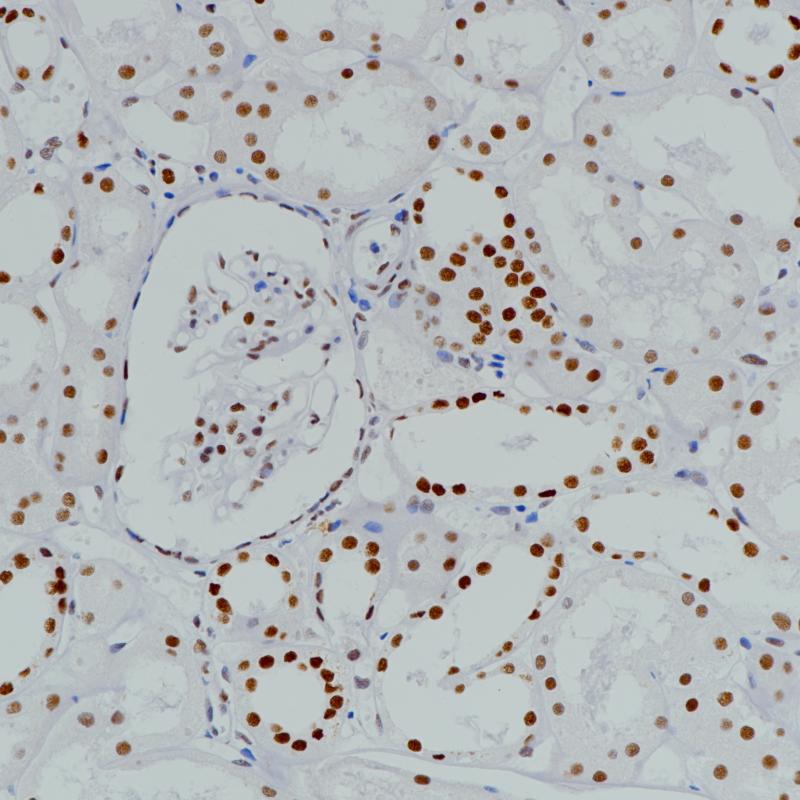 BRG1 Rabbit Monoclonal Antibody(ARB883)
