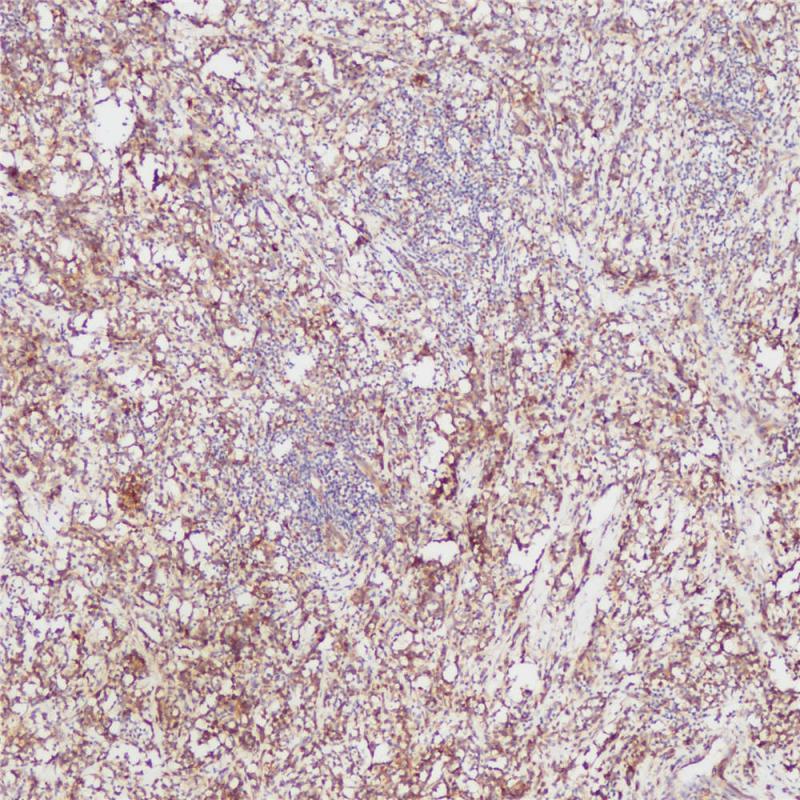 CD138 Rabbit Monoclonal Antibody(ARB889)