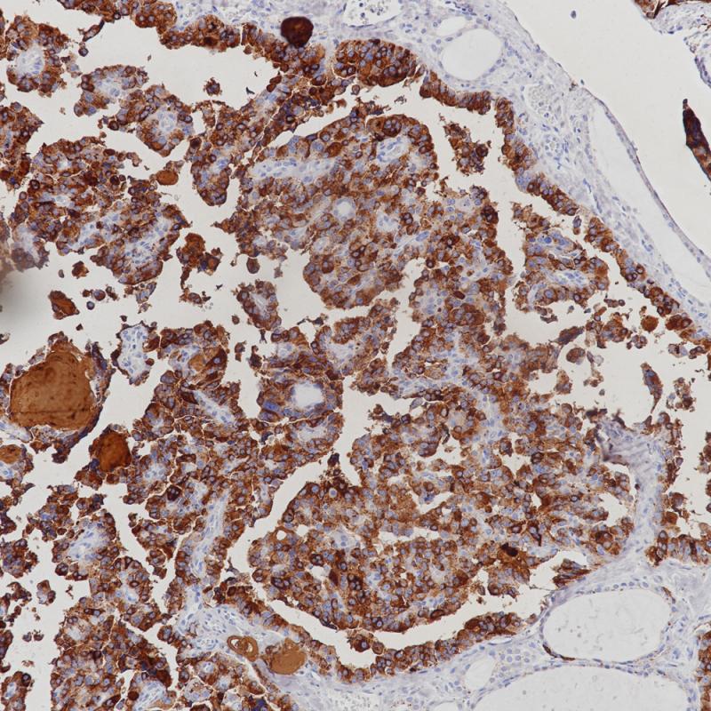 Calcitonin Rabbit Monoclonal Antibody(ARB885)