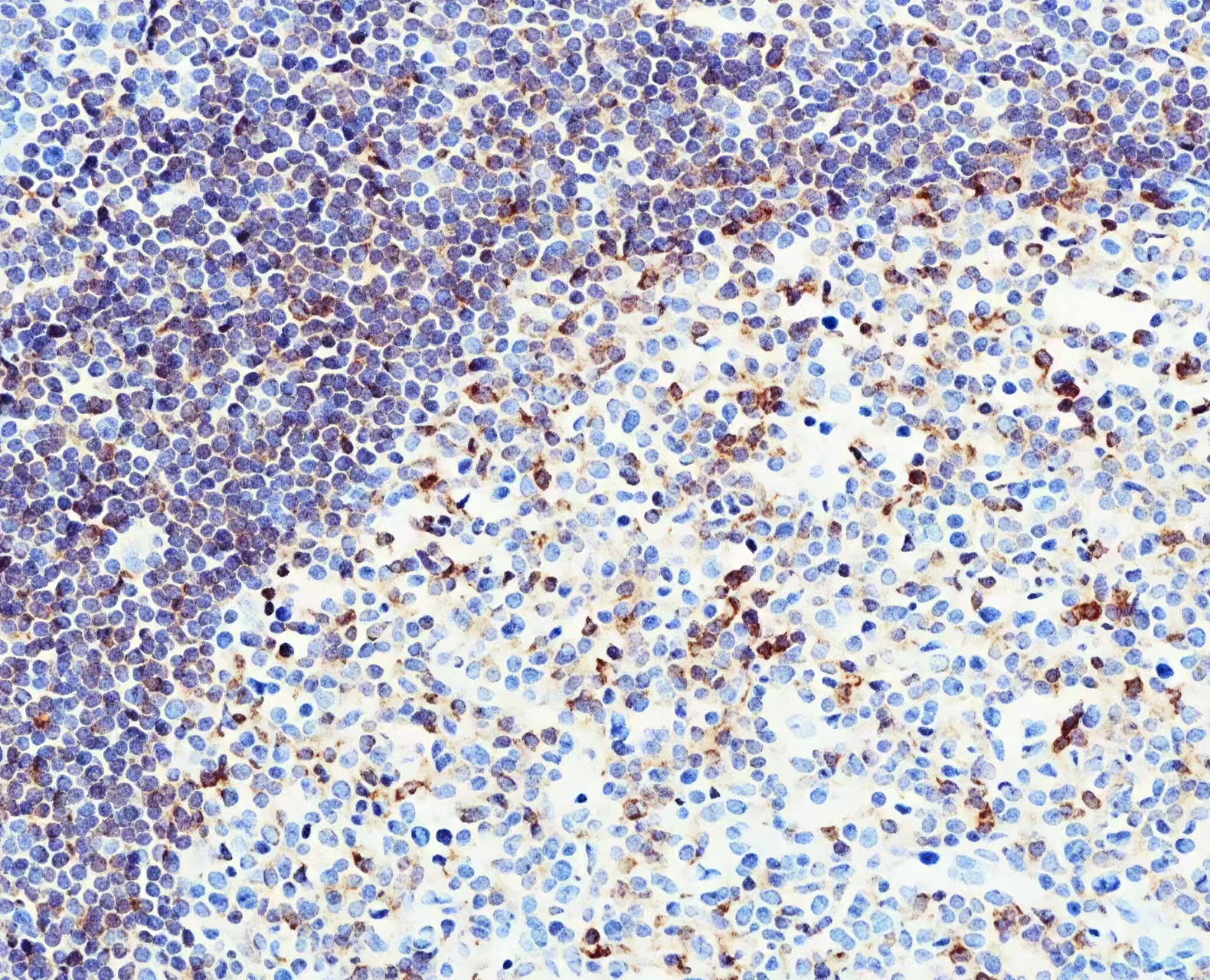 CXCR5 Rabbit Monoclonal Antibody(ARB931)