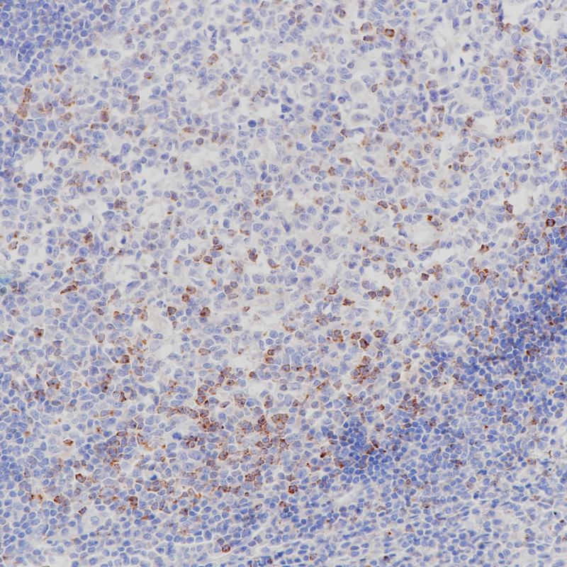 CTLA-4 Rabbit Monoclonal Antibody(ARB930)