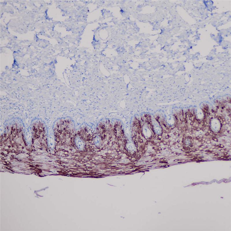 Cytokeratin 10 Rabbit Monoclonal Antibody(ARB934)