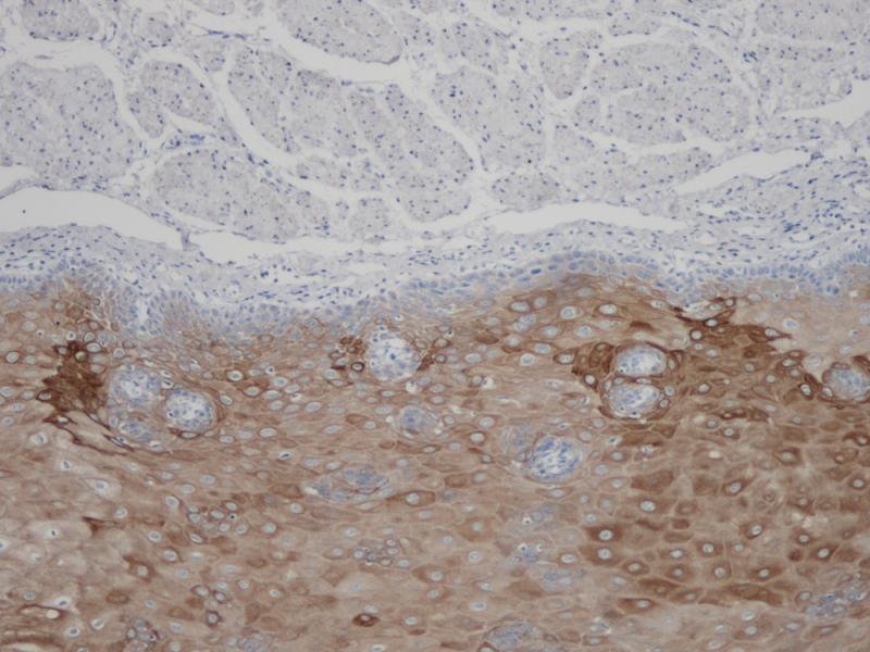 Cytokeratin 1 Rabbit Monoclonal Antibody(ARB933)