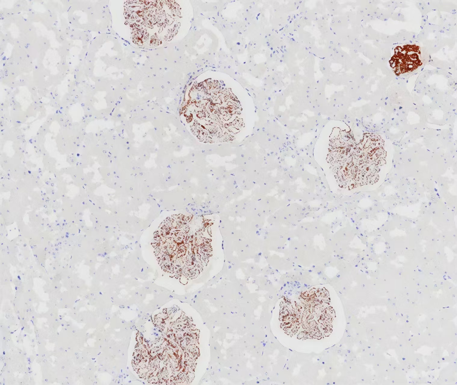 COL4A3 Rabbit Monoclonal Antibody(ARB927)