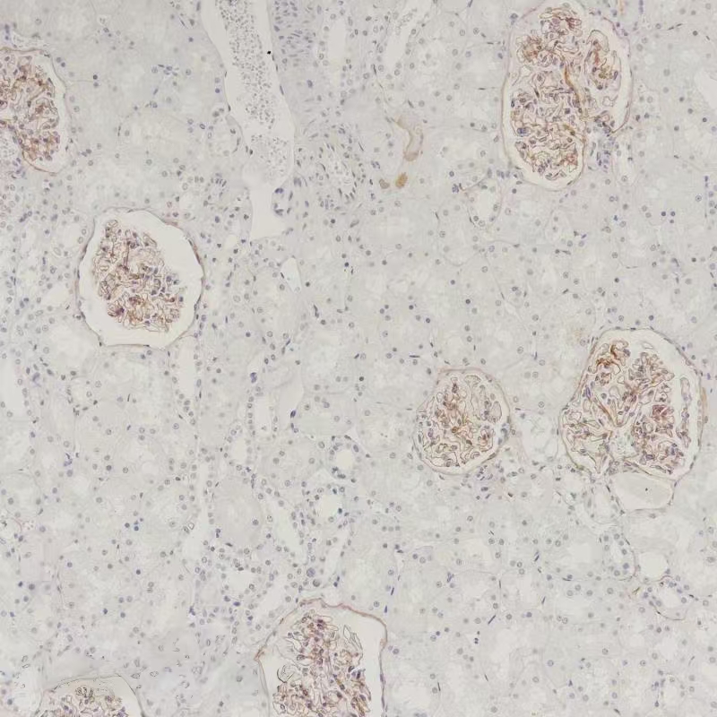 COL4A5 Rabbit Monoclonal Antibody(ARB928)