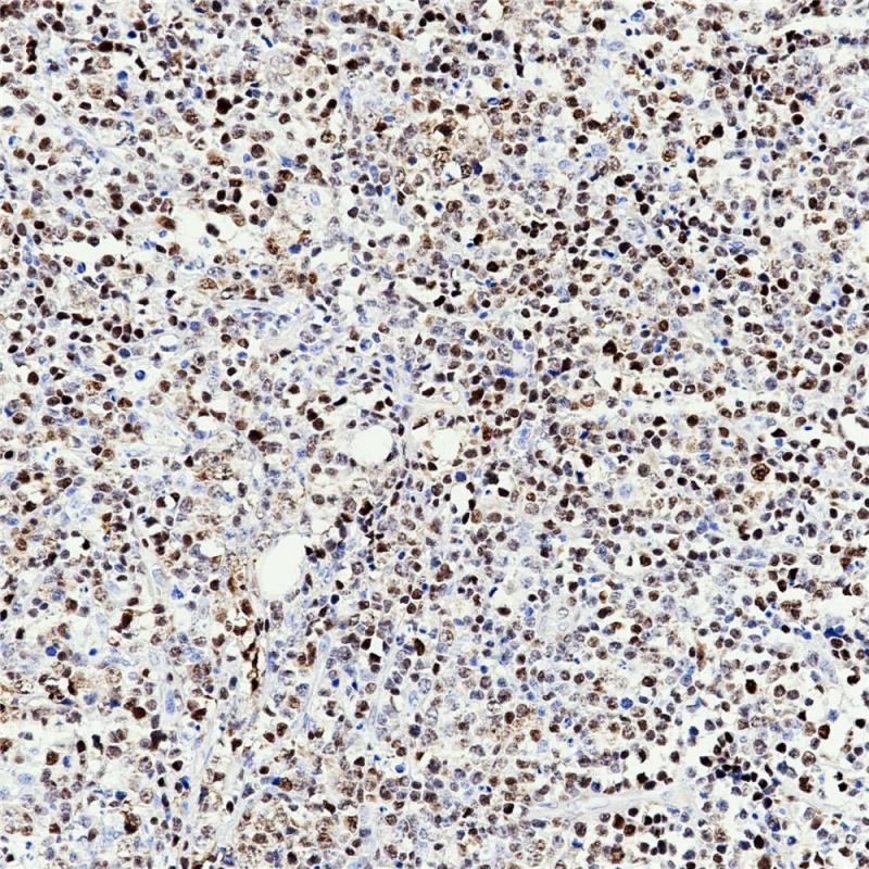 Cyclin D1 Rabbit Monoclonal Antibody(ARB932)