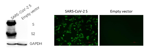 Anti-SARS-CoV-2 Spike Protein Mouse Monoclonal Antibody (G5)