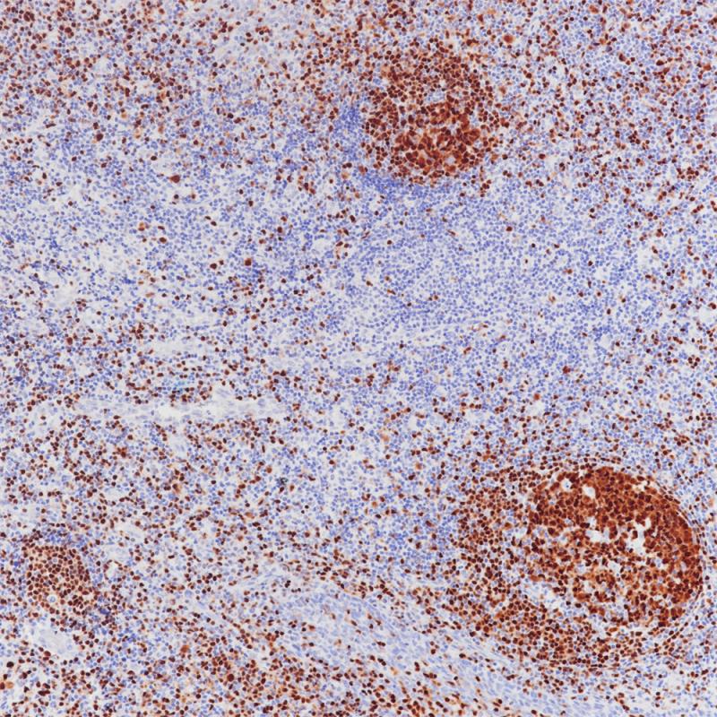 BSAP(PAX5) Mouse Monoclonal Antibody(ARB852)