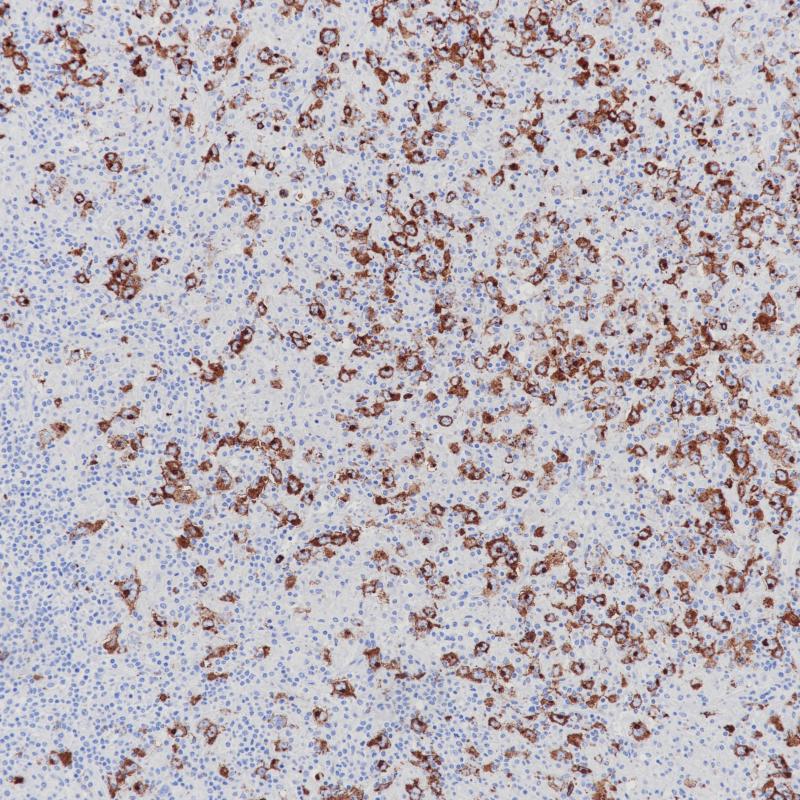 CD15 Mouse Monoclonal Antibody(ARB853)