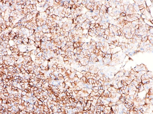 CD99 Rabbit Monoclonal Antibody(ARB916)