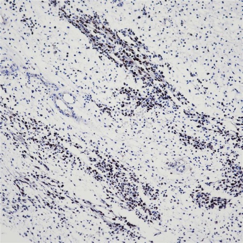 Myo D1 Rabbit Monoclonal Antibody(ARB860)