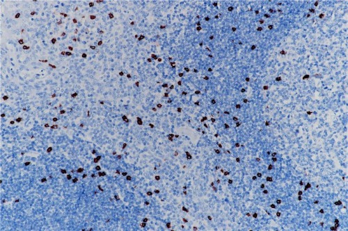 CD8 Rabbit Monoclonal Antibody(ARB915)