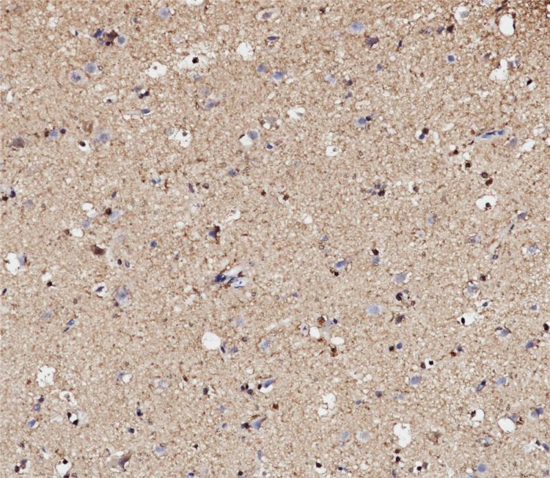 S100 Rabbit Monoclonal Antibody(ARB841)