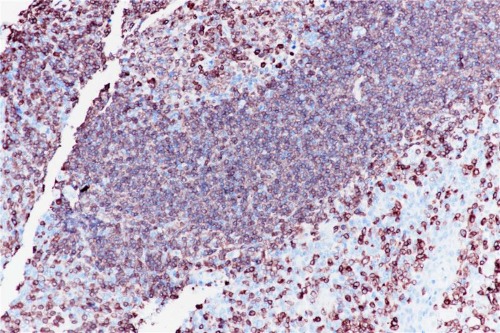 CD79a Rabbit Monoclonal Antibody(ARB914)