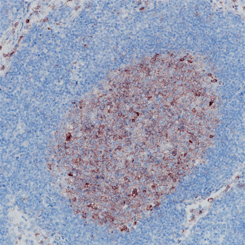 CD10 Rabbit Monoclonal Antibody(ARB836)